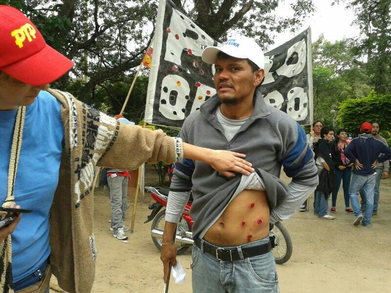 Los rastros de las balas de goma en un manifestante.