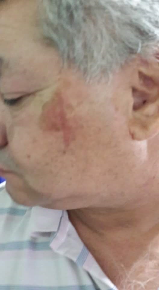 Así quedó el rostro del padre de Gómez, dirigente gremial detenido.