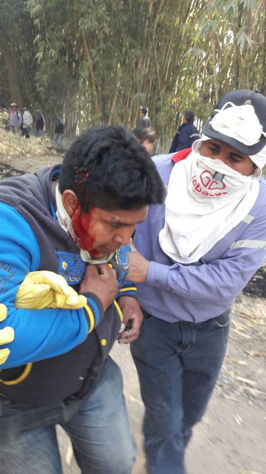 Obrero herido por un proyectil en la cabeza.